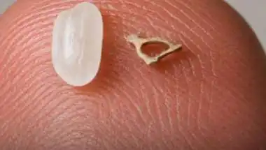 Unveiling the Human Body's Smallest Bone: A Tiny Marvel in Your Ear